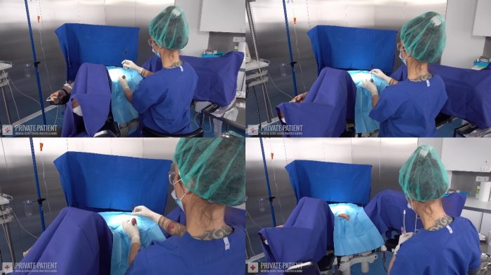 Private Patient – Cystoscopy 07