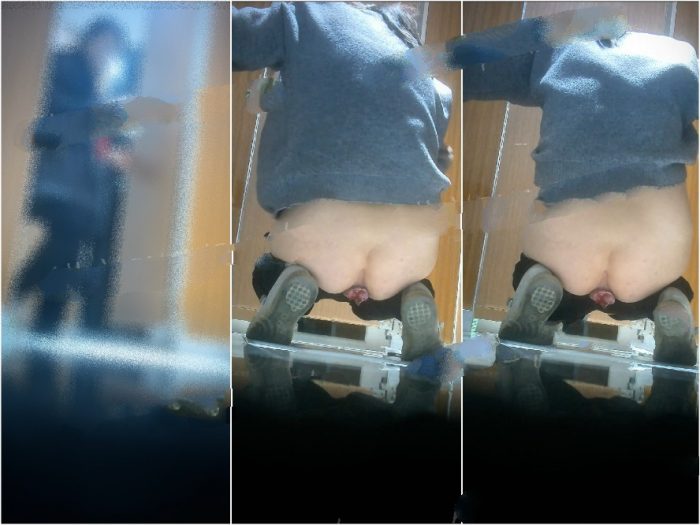 Hidden Camera 【激エロトイレ撮影】拳ほどもある超デカ痔
